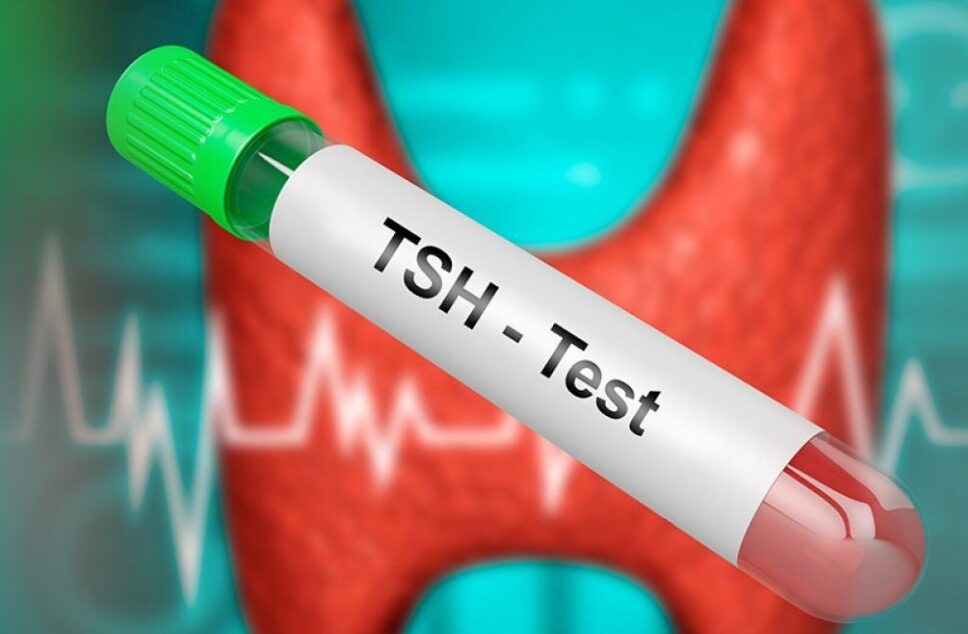 Llojet e testeve të tiroides – Pse është e rëndësishme t’i bëni