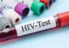 Dhjetë raste të reja me HIV në muajt e fundit, dy viktima – rritet testimi vullnetar