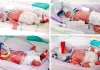 Rast i rrallë në botë: Nëna sjell në jetë katërnjaket identike